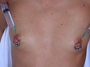 Salina de inyección en pezones mamarios bombeando tetas y vibrador