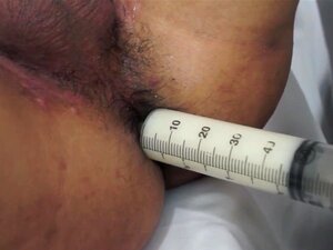 Doctor asiático inspecciona el culo de un twink